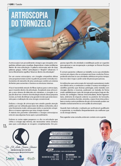 Artroscopia de Tornozelo